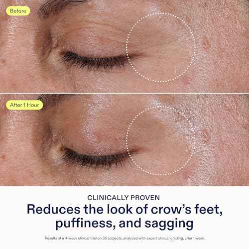 Skinfix Triple Lipid Eye Treatment - 0.5 fl oz - Eye Cream - Visibly Tightens, Depuffs & Smooths Undereyes - Non-Comedogenic - Fragrance Free - Vegan, Cruelty Free