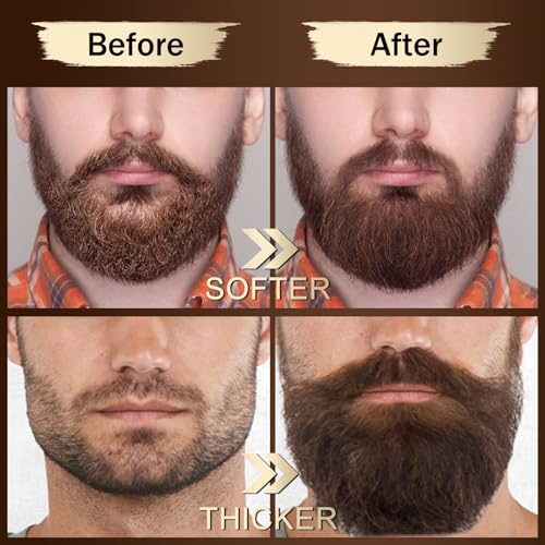 XIKEZAN Beard Kit for Men Grooming & Care Set w/2 Pack Beard Serum, Wash, Oil, Balm, Comb, Brush, Scissor, Bag, EBook, Unique Birthday Gifts for Men Him Dad Husband Brother Christmas Stocking Stuffers