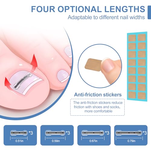12Pcs Ingrown Toenail Corrector Strips for Curved Toenail Quick Relief,4 Multi-Sizes Ingrown Toenail Treatment Relief Tools Kit for Home Use