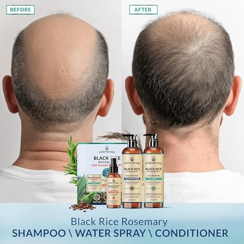 PureNaturis Black Rice Rosemary Hair Growth Set with Serum