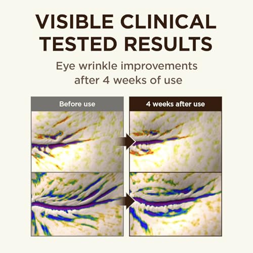 CKD Retinal 5X Gua Sha Eye Cream - Anti-Aging Eye Moisturizer for Wrinkles, Dark Circles & Puffiness ? Firming & Hydrating Under Eye Treatment with Retinal & Collagen. Korean Skincare. 1.01 fl oz.
