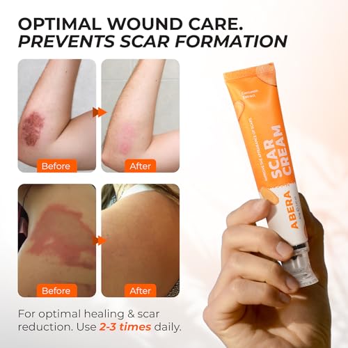 ABERA Scar Cream (Upgrade) - Skin Regeneration & Repair Cream - Heals Wounds, Promotes New Skin Formation, Soothes Scratches, Eczema, and Damaged Areas (1.41 Oz Per Item)