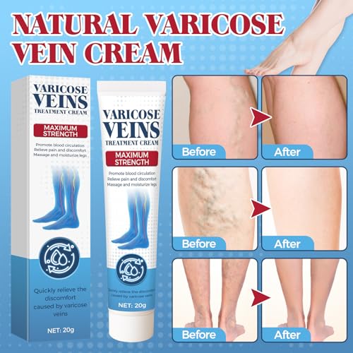 Varicose Veins Treatment for Legs, Varicose Veins Cream for Spider Veins, Relaxing Leg Cream Formula to Improve Circulation, Soothe Tired Legs and Reduce Heaviness