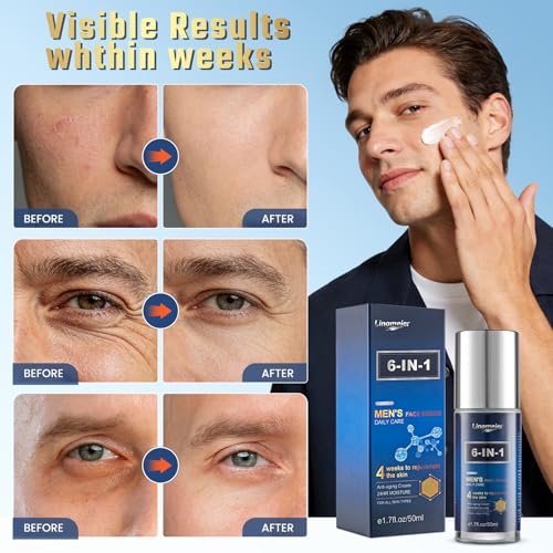 6 in 1 Mens Face Moisturizer, Anti Aging Face Cream for Men with Niacinamide, vitamin E, Hyaluronic Acid, Shea Butter, Deep hydration, Helps Reduce Dark Circles & Eye Bags,1.7 FL OZ