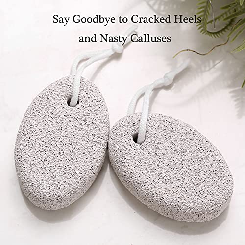 A&White Natural Pumice Stone for Feet and Hands - 2PCS Lava Pedicure Callus Remover
