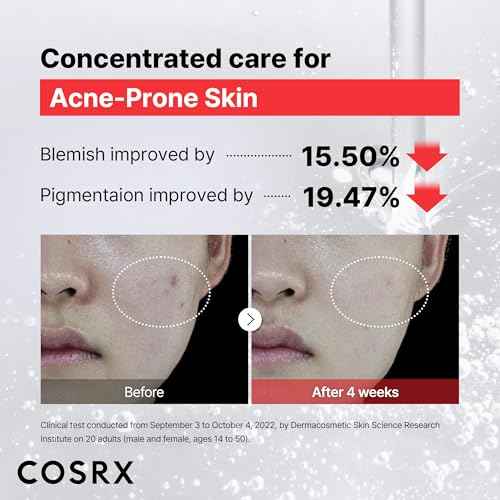 COSRX 15% Niacinamide Face Serum, 0.67 fl oz, Pore Minimizer Serum for Face, Even Skin Tone, Korean Skin Care, Stocking Stuffers, Gifts For Women