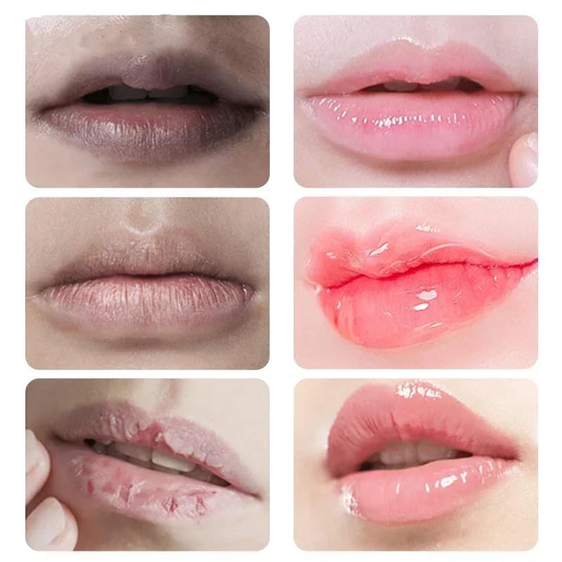 Lip Lightening Scrub Balm - Exfoliating Moisturizer for Dark Lips