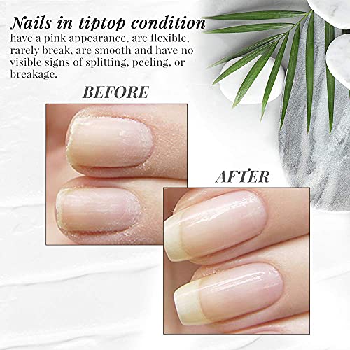 Nail Tek Foundation 1, Ridge Filling Strengthening Base Coat for Strong, Healthy Nails, 0.5 oz, 2-Pack