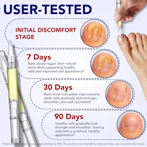 VOFANK Toenail Fungus Pen with 25% Undecylenic Acid - Extra Strength Nail Treatment for Discolored, Damaged Nails