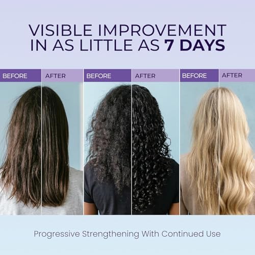 Biotin Shampoo & Conditioner Set - Repair Damaged Hair, 10.1 FL OZ