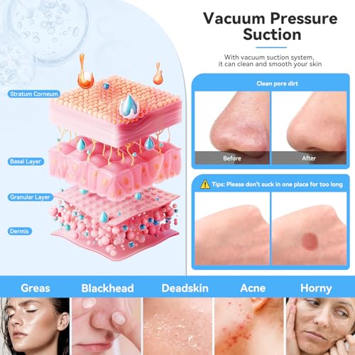 Diamond Microdermabrasion Facial Machine with 9 Heads & LCD