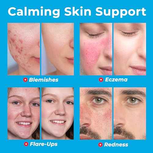 Hypochlorous Acid Spray for Face (8oz, Reduces Acne), Targets Bacteria - HOCL Facial Cleanser Acne Spray for Face, Body, Eczema, Pimples, Breakouts & Overall Skin Recovery (Reduces Redness)