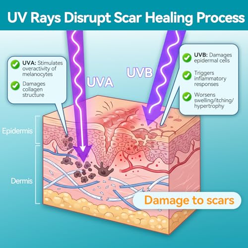 Dimora UPF50+ Silicone Scar Sheets with UV Protection Reusable Sheets to Soften, Flatten Fade Scars, Reduce Redness for Surgical, C-Section, Burn, Keloid, and Hypertrophic Scars (1.6¡±x78.7 Roll)