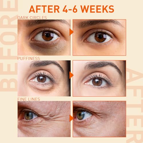 Under Eye Serum for Dark Circles, Puffiness & Fine Lines ? 5% Caffeine Eye Serum for Smoother, Refreshed-Looking Skin ? 0.56 oz