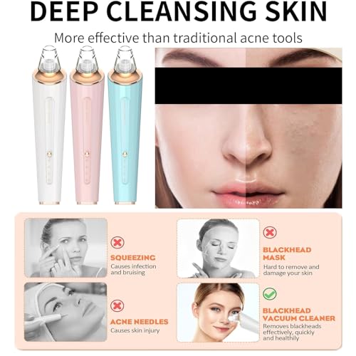 Upgraded Blackhead Remover Pore Vacuum with 3 Probes & 3 Suction Levels