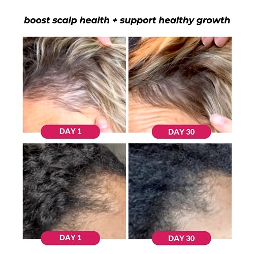 Love Ur Curls Healthy Scalp Serum for Thicker & Fuller Curls - 50 mL