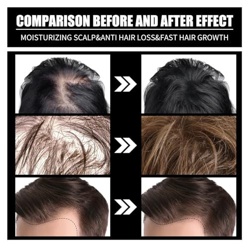Biotin Hair Growth Serum Oil with Collagen & Rosemary