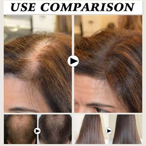 YIVANNUO 2PCS Deoxyribose Sugar Hair Growth Gel Serum 60ml