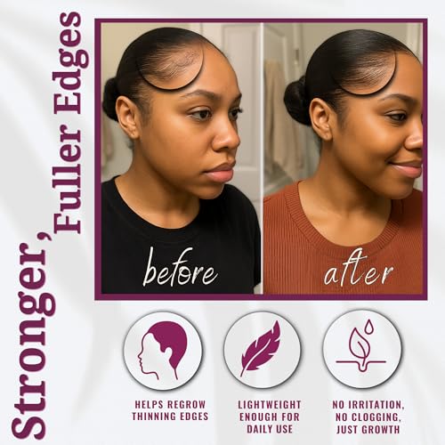 Batana Oil for 4C Hair Growth & Edges | 100% Pure