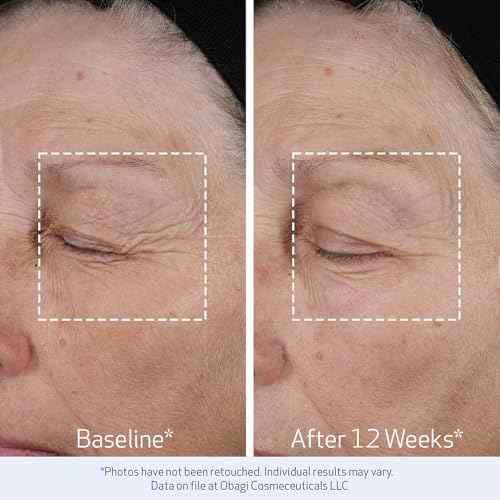 Obagi ELASTIderm Lift Up & Sculpt Facial Moisturizer ? Clinically Proven Anti-Aging Face Cream that Visibly Firms & Sculpts Facial Contours, & Reduces Fine Lines & Wrinkles with Peptides ? 1.7 oz