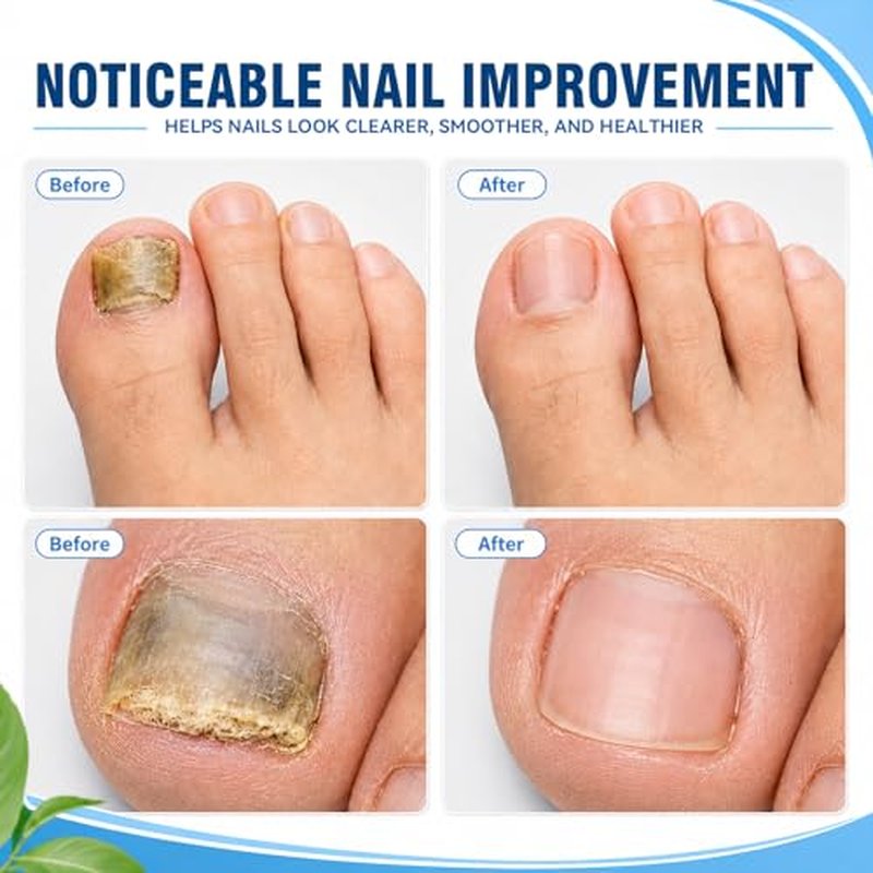 Overnight Nail Care Patches - 21 Count Toenail Treatment
