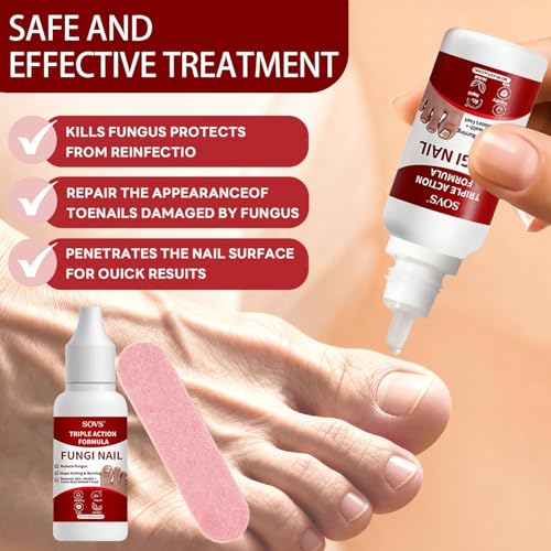 SOVS Toenail Treatment Liquid - Nail Care Solution