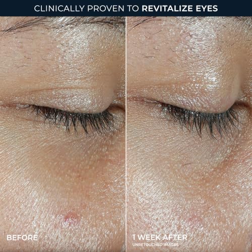 RoC Multi Correxion Revive + Glow Eye Balm with Vitamin C
