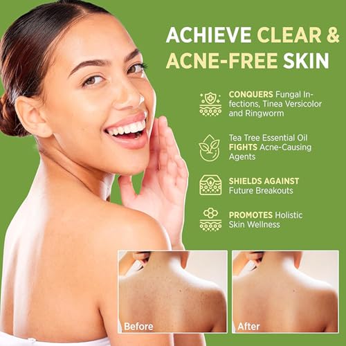 Tea Tree Soap, Relief Soap Bar Infused with Tea Tree Oil, Natural Foot & Body Soaps for Healthy Skin, Addresses Foot Discomfort and Skin Irritations, Gentle Exfoliating Bar Soap for Men Women