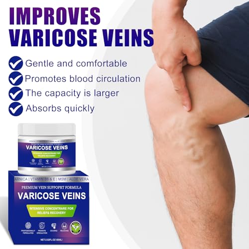 Varicose Veins Cream for Legs with Arnica & Aloe Vera