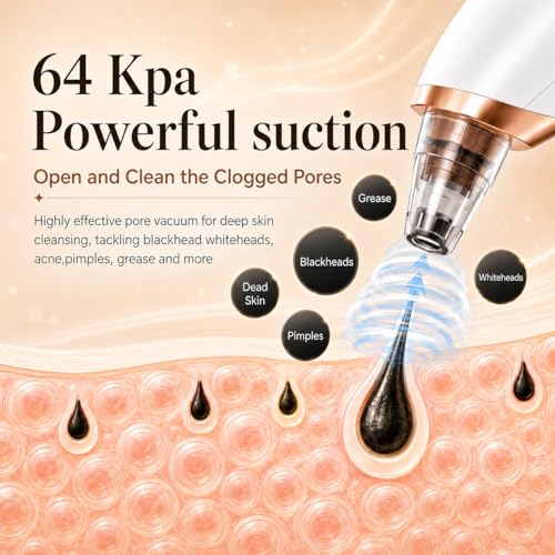 Blackhead Remover Vacuum with 3 Suction Levels & 5 Probes