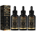 5% Minoxidil Hair Growth Serum for Men & Women - Strengthens Follicles, Prevents Hair Loss