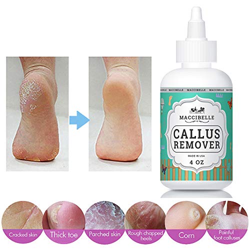 Maccibelle Extra Strength Callus Remover Liquid Gel for Feet (4 oz)