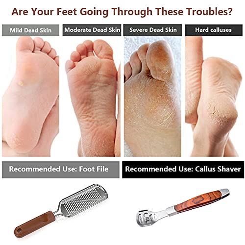 2-Pack Pedicure Kit - Stainless Steel Foot Rasp & Wood Callus Shaver Set