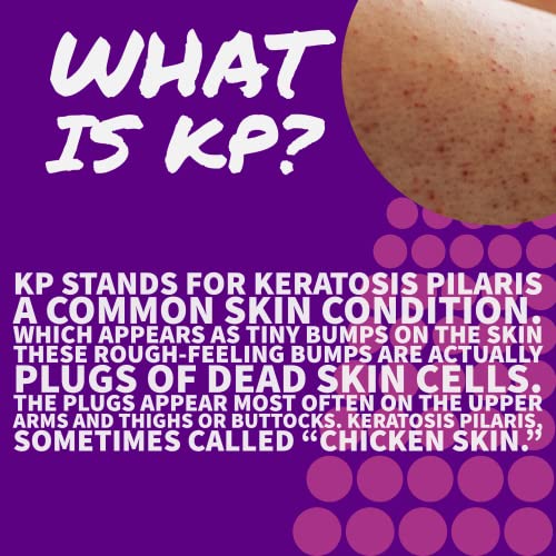 KP Keratosis Pilaris Treatment, KP Bump Eraser Hydrating lotion, Bumps Be Gone, Moisturizing and exfoliating lotion For Rough and Bumpy Dry Skin For Body, 8 Oz