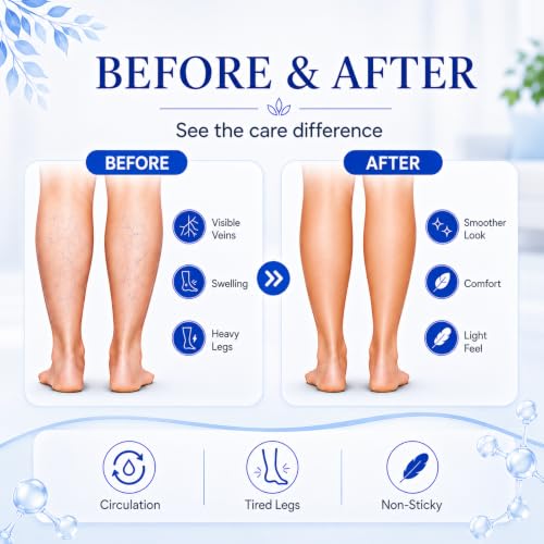 Varicose Veins Relief Cream with Arnica & Witch Hazel