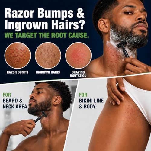Folliculitis Treatment Cream for Razor Bumps & Ingrown Hairs