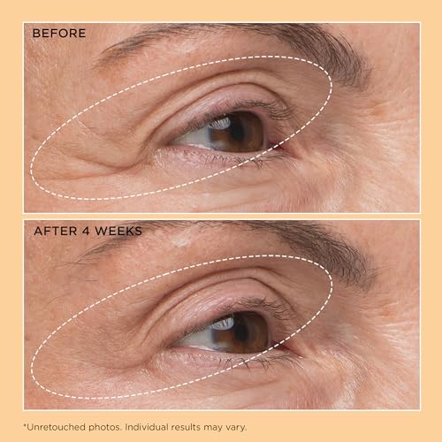Perricone MD Neuropeptide Eyelid Lift Serum 0.5fl oz
