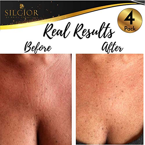 SILCÍOR 4 Pack Anti-Wrinkle Silicone Chest Pads for Wrinkle Reduction, Reusable & Skin-Friendly