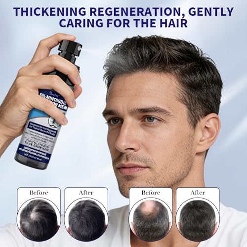 Men's 5% Minoxidil Hair Regrowth Spray – Biotin & Rosemary