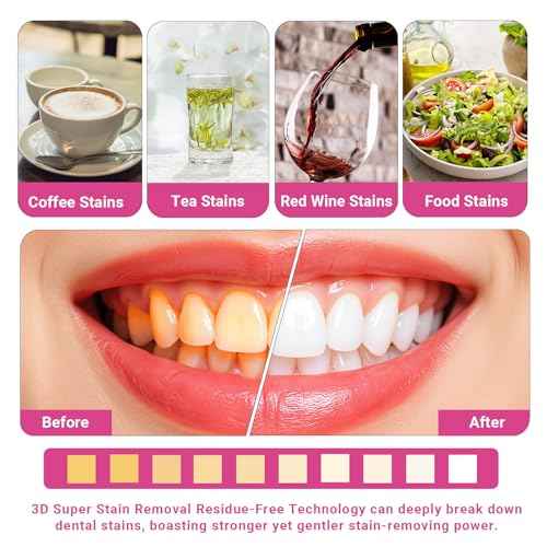 CALLSMILE Teeth Whitening Strips Kit 16 Treatments - Whitening Strips for Sensitive People, Fast Remove Smoking, Coffee, Wine Stains, White Strips for Teeth Whitening (32 Strips)