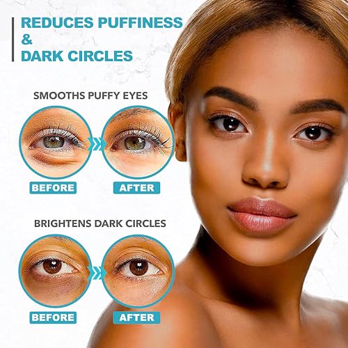 Retinol Collagen Under Eye Patches - 60 Gel Pads for Dark Circles