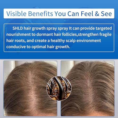 Hair Growth Spray with Rosemary Oil & Biotin for Thinning Hair