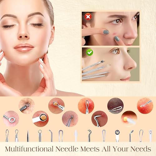 22-Piece Blackhead Remover Kit - Stainless Steel Pimple Extractor Tools