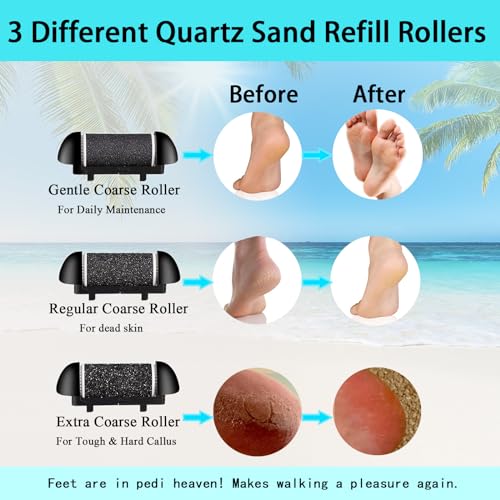 CIVYPRO Electric Foot Callus Remover - Rechargeable IPX7 Pedicure Tool Set