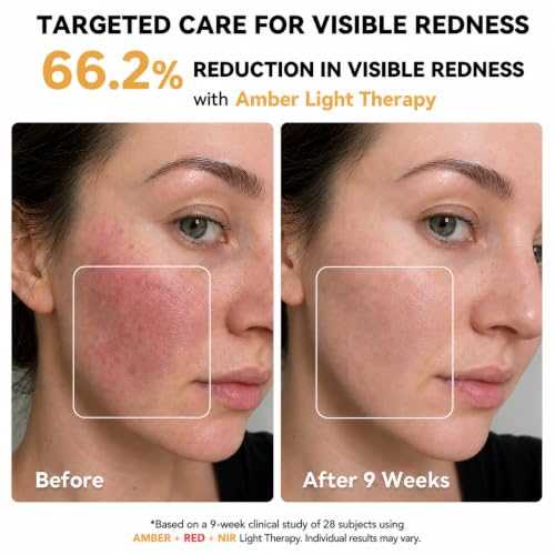 Red Light Therapy LED Face Mask for Acne & Fine Lines