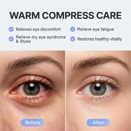 30 Pack Self-Heating Steam Eye Masks for Dry Eyes