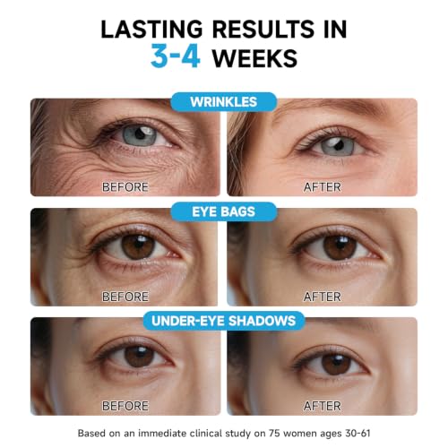 Instant Eye Lift & Retinol Cream for Bags, Wrinkles & Puffiness