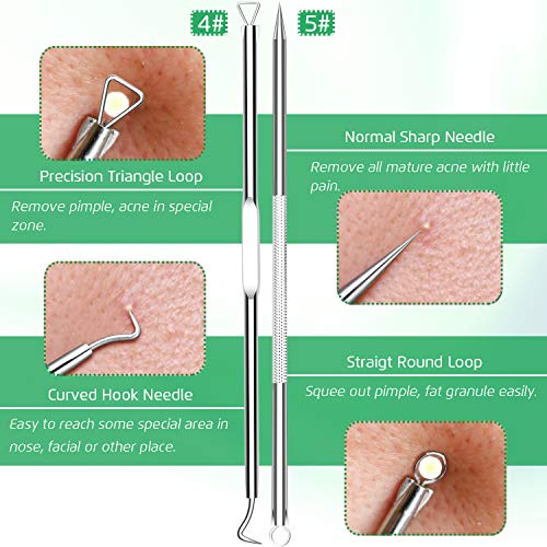 5-Piece Blackhead Remover Kit, Professional Stainless Steel Comedone Extractors