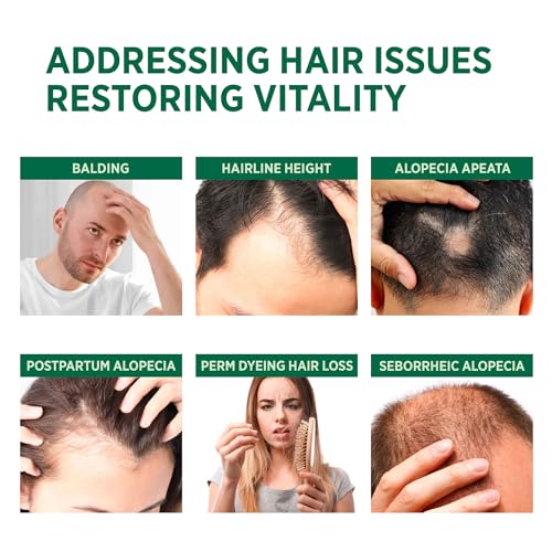 Svvimer Biotin Rosemary Hair Thickening Shampoo & Conditioner