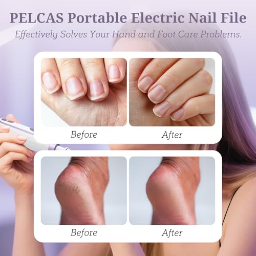 Electric Toenail Grinder & Nail Drill Kit - 5 Speeds, LED Light
